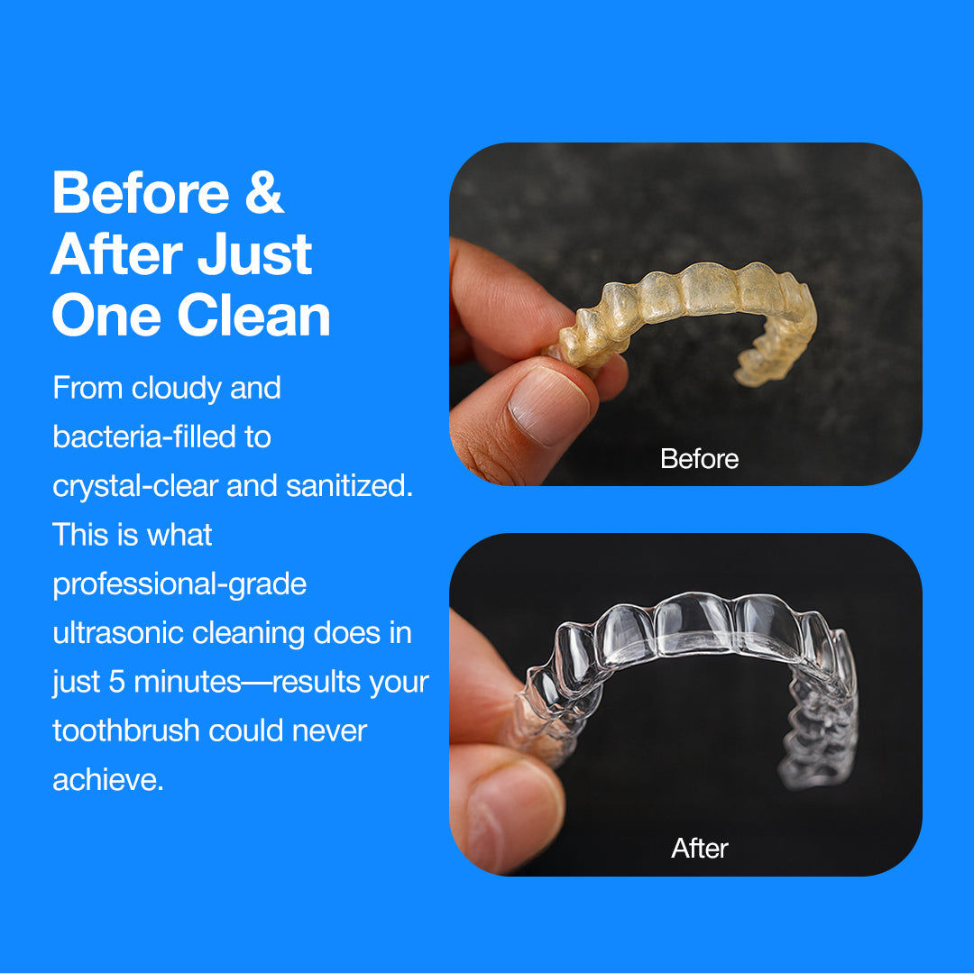 DentalPULSE Pod Max